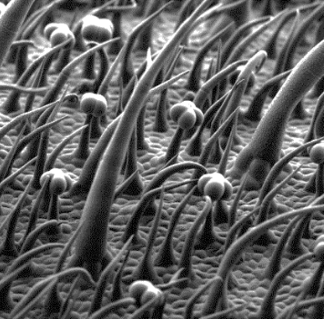Tomato glandular trichomes