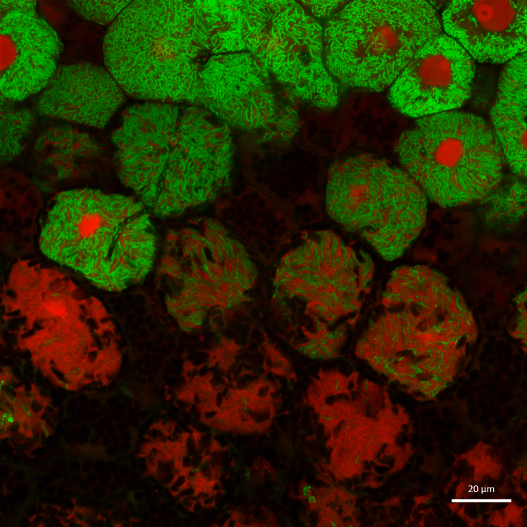 Survie des rhizobia dans les nodosités d’un mutant de sénescence. Les bactéroïdes différenciés morts sont visualisés en rouge dans les cellules de nodosités d’un mutant de sénescence, alors que les rhizobia colorés en vert sont vivants.